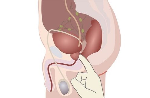 男性前列腺的解剖
